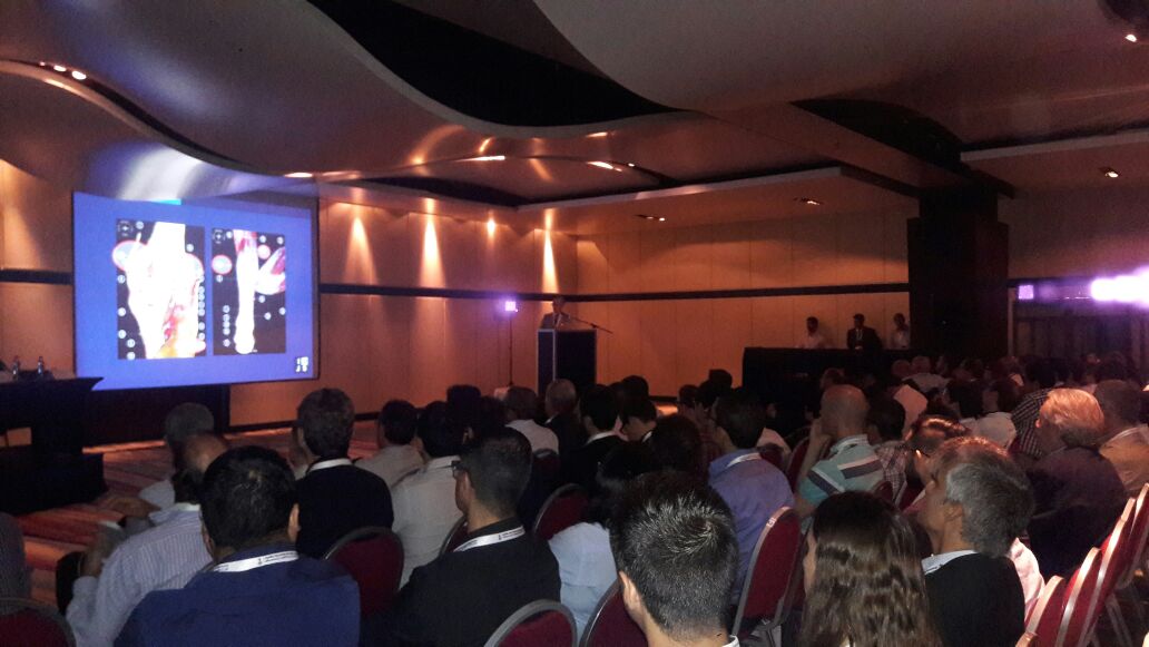 El Dr. Juan Pablo Calvi en su conferencia de Alargamiento de Gemelos para el tratamiento de la metatarsalgia.